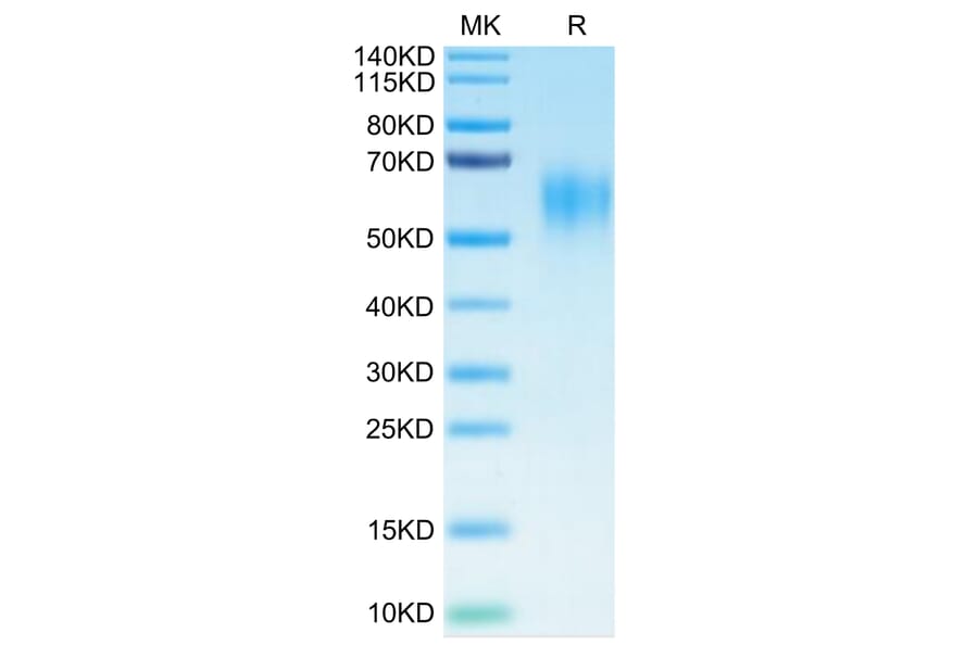 Tris-Bis PAGE - Recombinant Human IL-15RA Protein (C-terminal His and Avi Tag) (A330824) - Antibodies.com