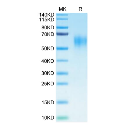 Tris-Bis PAGE - Recombinant Human IL-15RA Protein (C-terminal His and Avi Tag) (A330824) - Antibodies.com