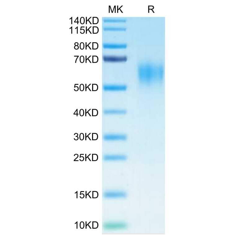 Tris-Bis PAGE - Recombinant Human IL-15RA Protein (C-terminal His and Avi Tag) (A330824) - Antibodies.com