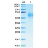 Tris-Bis PAGE - Recombinant Human IL-15RA Protein (C-terminal His and Avi Tag) (A330824) - Antibodies.com