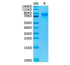 Tris-Bis PAGE - Recombinant Human IL-15RA Protein (C-terminal Human Fc Tag) (A330825) - Antibodies.com