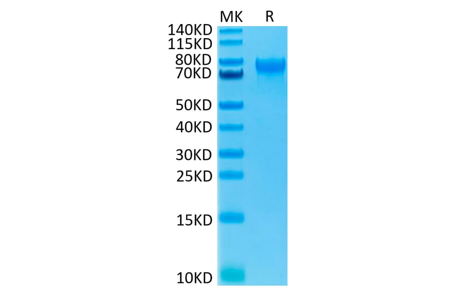 Tris-Bis PAGE - Recombinant Human IL-15RA Protein (C-terminal Human Fc Tag) (A330825) - Antibodies.com