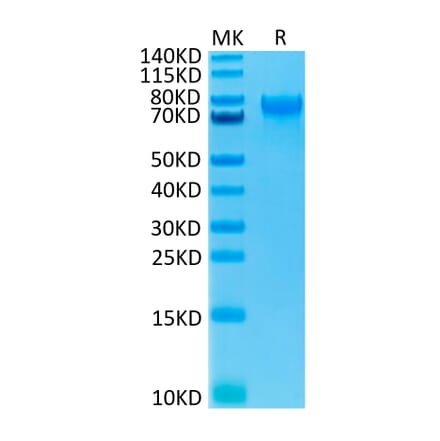 Tris-Bis PAGE - Recombinant Human IL-15RA Protein (C-terminal Human Fc Tag) (A330825) - Antibodies.com