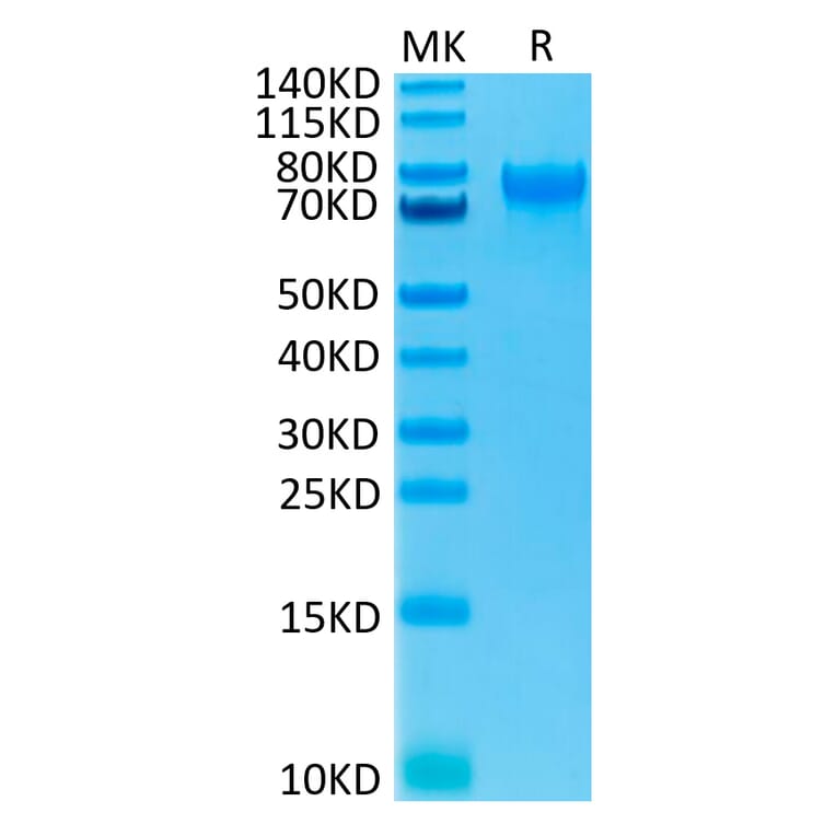 Tris-Bis PAGE - Recombinant Human IL-15RA Protein (C-terminal Human Fc Tag) (A330825) - Antibodies.com