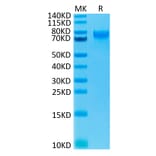 Tris-Bis PAGE - Recombinant Human IL-15RA Protein (C-terminal Human Fc Tag) (A330825) - Antibodies.com