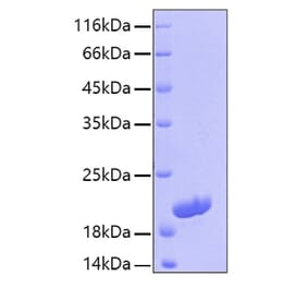 SDS-PAGE - Recombinant Human IL-16 Protein (C-terminal His Tag) (A330826) - Antibodies.com