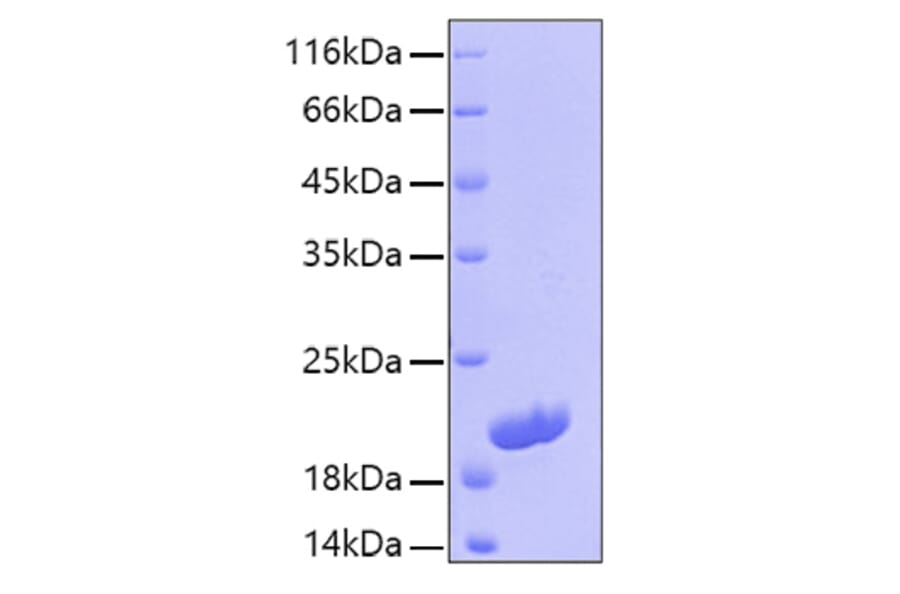 SDS-PAGE - Recombinant Human IL-16 Protein (C-terminal His Tag) (A330826) - Antibodies.com