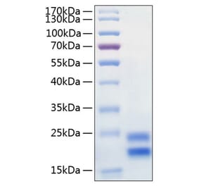 SDS-PAGE - Recombinant Human IL-17A Protein (C-terminal His Tag) (A330827) - Antibodies.com