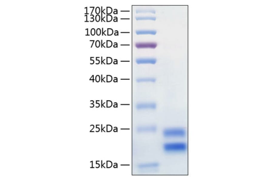 SDS-PAGE - Recombinant Human IL-17A Protein (C-terminal His Tag) (A330827) - Antibodies.com