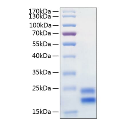 SDS-PAGE - Recombinant Human IL-17A Protein (C-terminal His Tag) (A330827) - Antibodies.com