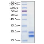 SDS-PAGE - Recombinant Human IL-17A Protein (C-terminal His Tag) (A330827) - Antibodies.com