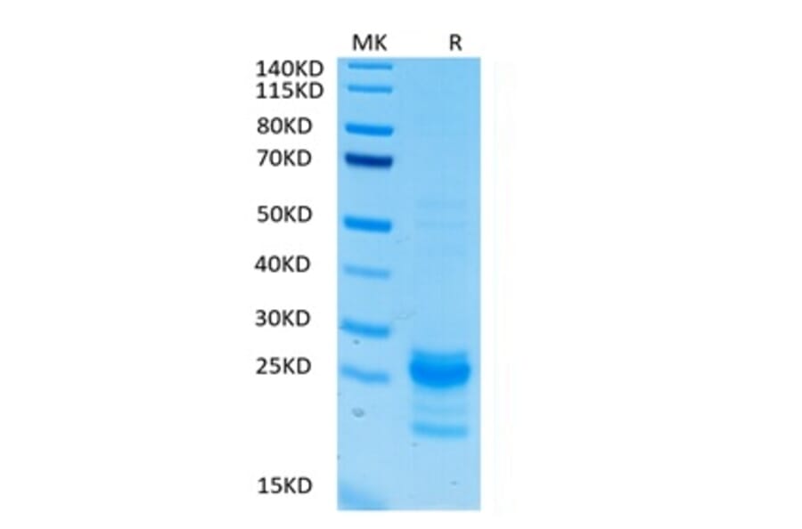 Tris-Bis PAGE - Recombinant Human IL-17A Protein (Biotin) (C-terminal His and Avi Tag) (A330828) - Antibodies.com