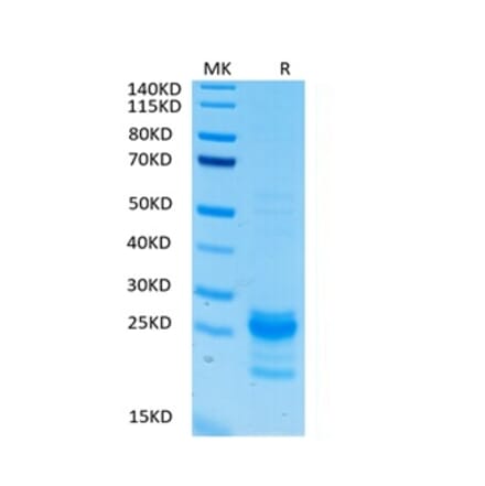 Tris-Bis PAGE - Recombinant Human IL-17A Protein (Biotin) (C-terminal His and Avi Tag) (A330828) - Antibodies.com