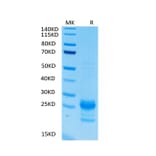 Tris-Bis PAGE - Recombinant Human IL-17A Protein (Biotin) (C-terminal His and Avi Tag) (A330828) - Antibodies.com