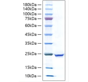 SDS-PAGE - Recombinant Human IL-17C Protein (C-terminal His Tag) (A330829) - Antibodies.com