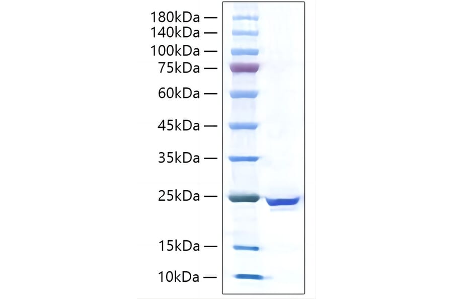 SDS-PAGE - Recombinant Human IL-17C Protein (C-terminal His Tag) (A330829) - Antibodies.com