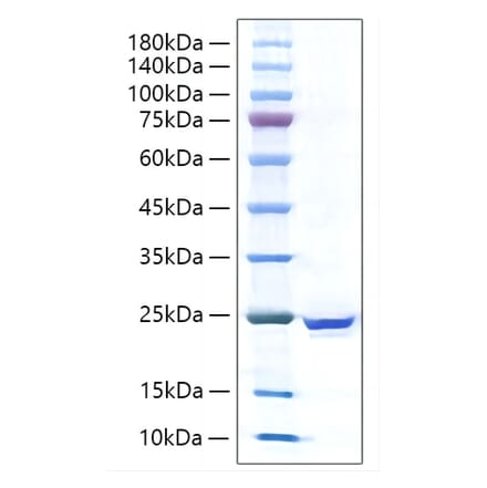 SDS-PAGE - Recombinant Human IL-17C Protein (C-terminal His Tag) (A330829) - Antibodies.com