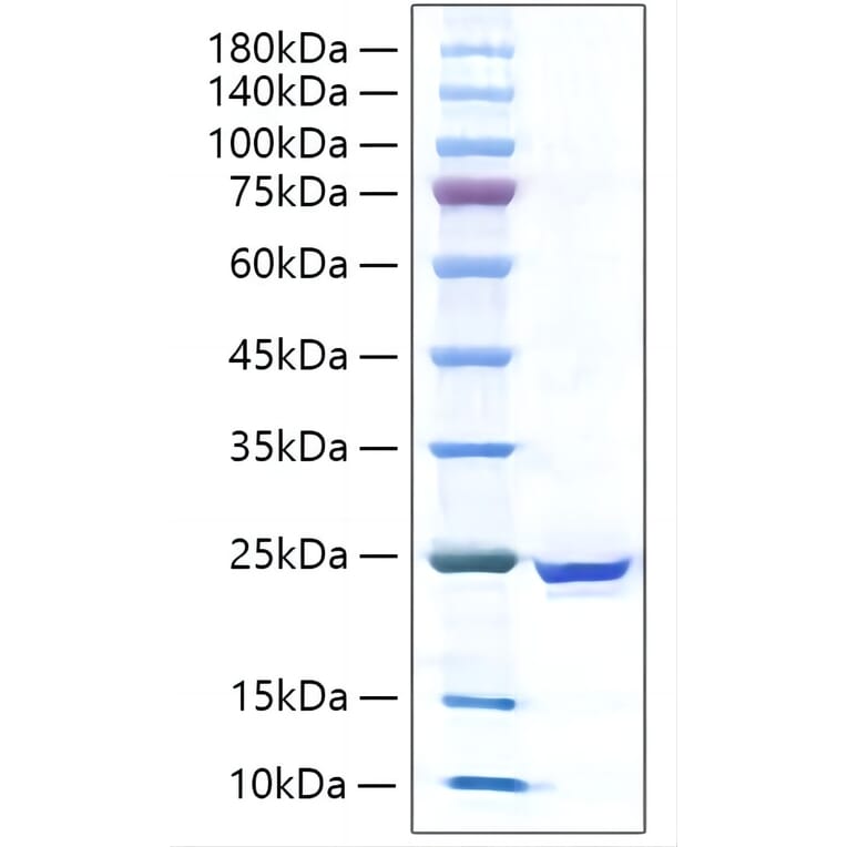 SDS-PAGE - Recombinant Human IL-17C Protein (C-terminal His Tag) (A330829) - Antibodies.com