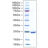 SDS-PAGE - Recombinant Human IL-17C Protein (C-terminal His Tag) (A330829) - Antibodies.com