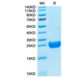 Tris-Bis PAGE - Recombinant Cynomolgus macaque IL-17F Protein (C-terminal His Tag) (A330830) - Antibodies.com