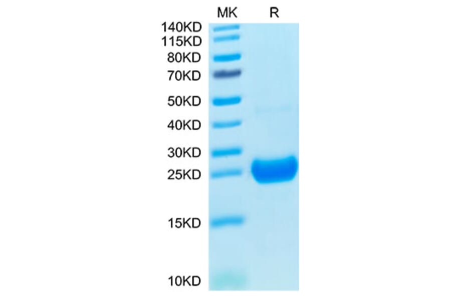Tris-Bis PAGE - Recombinant Cynomolgus macaque IL-17F Protein (C-terminal His Tag) (A330830) - Antibodies.com