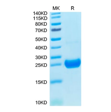 Tris-Bis PAGE - Recombinant Cynomolgus macaque IL-17F Protein (C-terminal His Tag) (A330830) - Antibodies.com