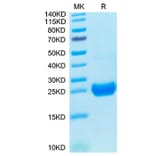 Tris-Bis PAGE - Recombinant Cynomolgus macaque IL-17F Protein (C-terminal His Tag) (A330830) - Antibodies.com