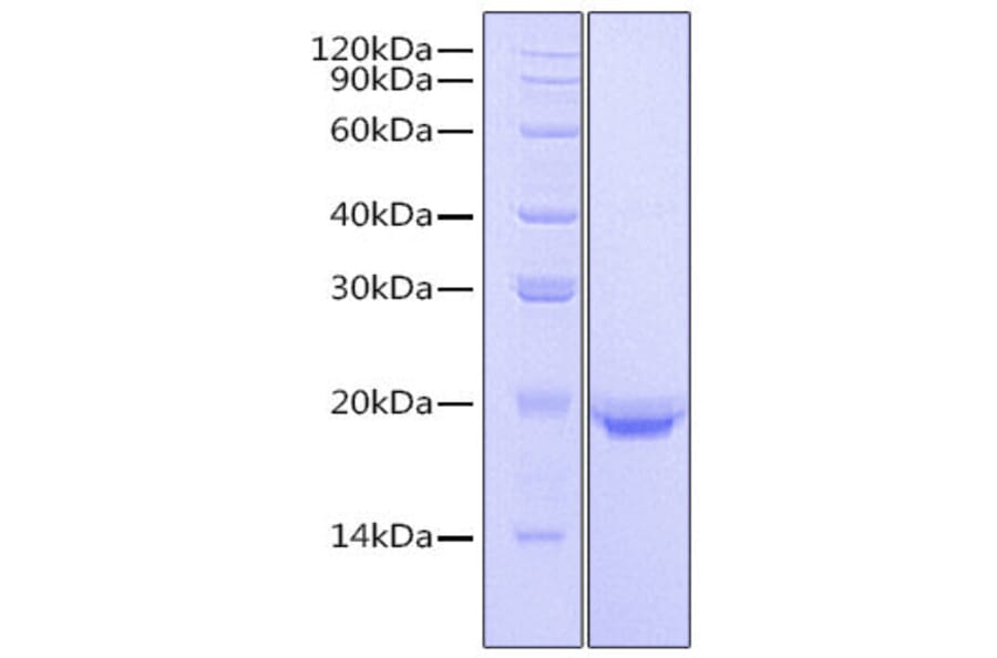 SDS-PAGE - Recombinant Human IL-17F Protein (N-terminal His Tag) (A330831) - Antibodies.com