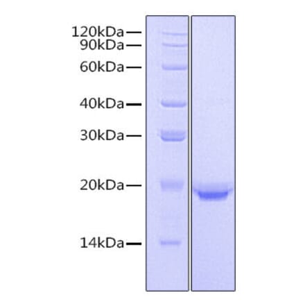 SDS-PAGE - Recombinant Human IL-17F Protein (N-terminal His Tag) (A330831) - Antibodies.com