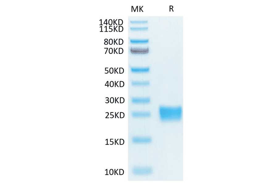 Tris-Bis PAGE - Recombinant Human IL-17F Protein (Biotin) (C-terminal His and Avi Tag) (A330832) - Antibodies.com