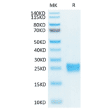 Tris-Bis PAGE - Recombinant Human IL-17F Protein (Biotin) (C-terminal His and Avi Tag) (A330832) - Antibodies.com