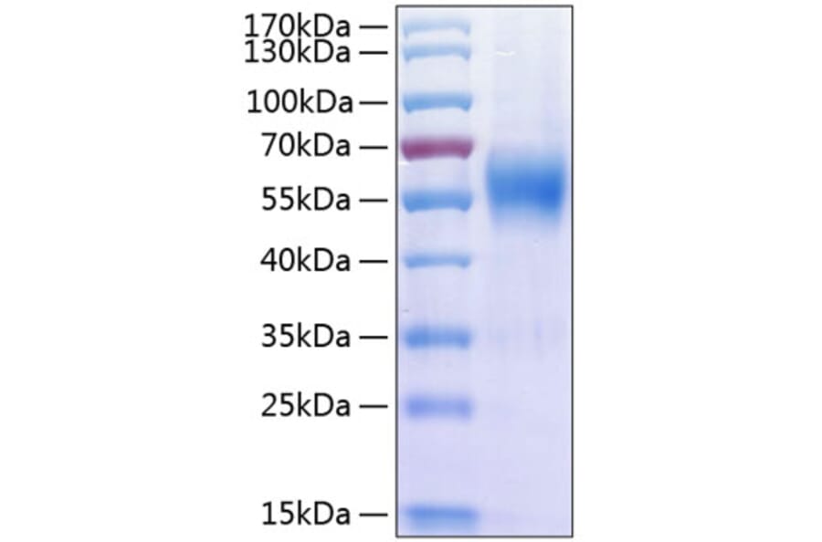 SDS-PAGE - Recombinant Human IL-17RA Receptor Protein (C-terminal His Tag) (A330833) - Antibodies.com