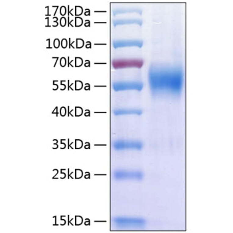 SDS-PAGE - Recombinant Human IL-17RA Receptor Protein (C-terminal His Tag) (A330833) - Antibodies.com
