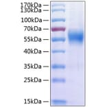 SDS-PAGE - Recombinant Human IL-17RA Receptor Protein (C-terminal His Tag) (A330833) - Antibodies.com