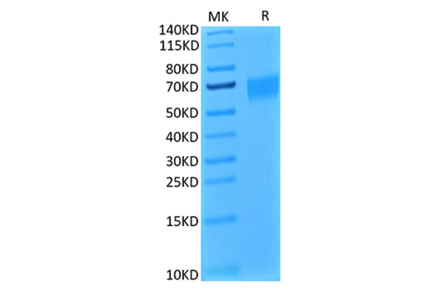 Tris-Bis PAGE - Recombinant Human IL-17RA Receptor Protein (Biotin) (C-terminal His and Avi Tag) (A330834) - Antibodies.com