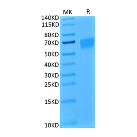 Tris-Bis PAGE - Recombinant Human IL-17RA Receptor Protein (Biotin) (C-terminal His and Avi Tag) (A330834) - Antibodies.com