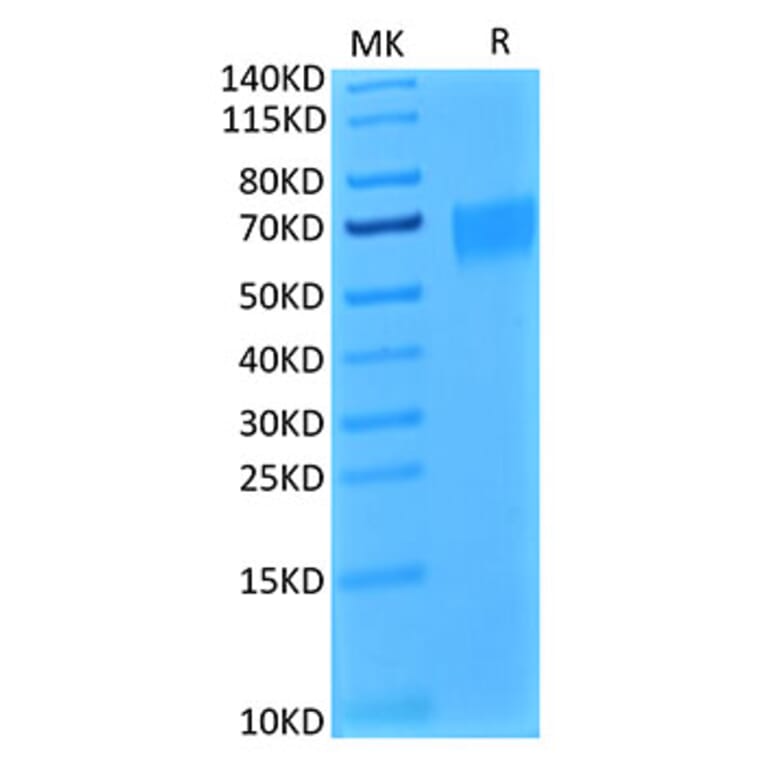 Tris-Bis PAGE - Recombinant Human IL-17RA Receptor Protein (Biotin) (C-terminal His and Avi Tag) (A330834) - Antibodies.com