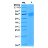 Tris-Bis PAGE - Recombinant Human IL-17RA Receptor Protein (Biotin) (C-terminal His and Avi Tag) (A330834) - Antibodies.com