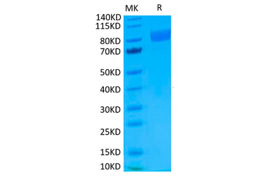 Tris-Bis PAGE - Recombinant Human IL-17RA Receptor Protein (Biotin) (C-terminal Human Fc and Avi Tag) (A330835) - Antibodies.com