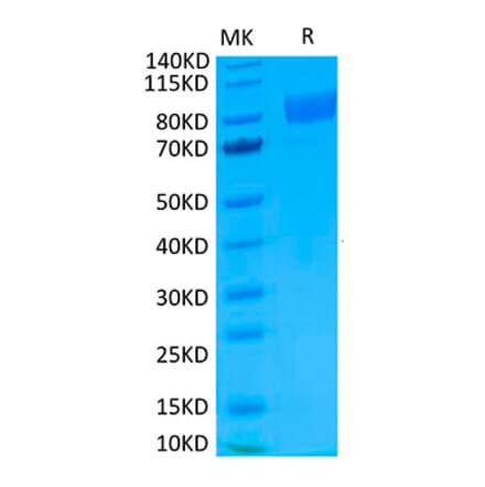 Tris-Bis PAGE - Recombinant Human IL-17RA Receptor Protein (Biotin) (C-terminal Human Fc and Avi Tag) (A330835) - Antibodies.com