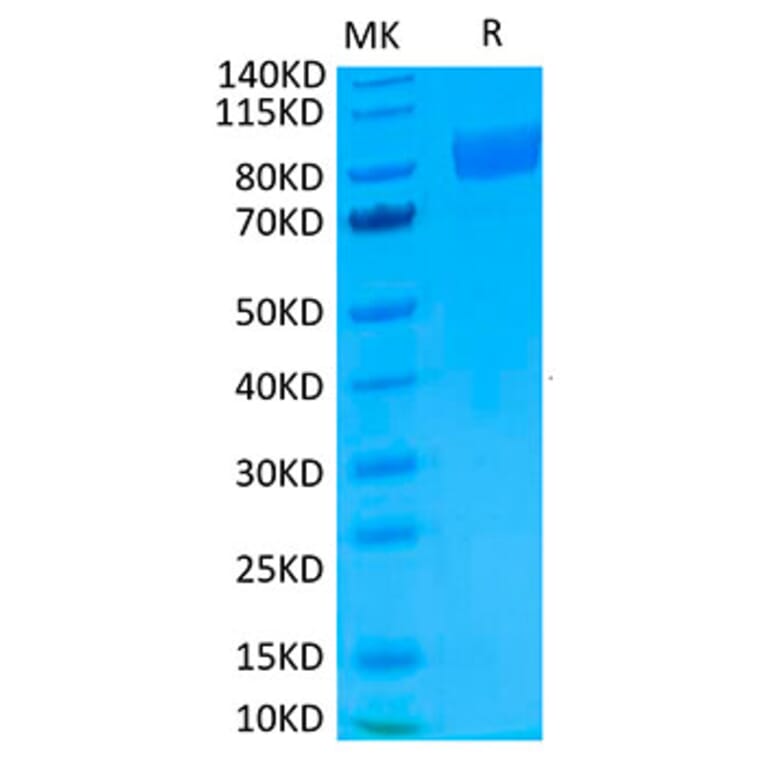 Tris-Bis PAGE - Recombinant Human IL-17RA Receptor Protein (Biotin) (C-terminal Human Fc and Avi Tag) (A330835) - Antibodies.com