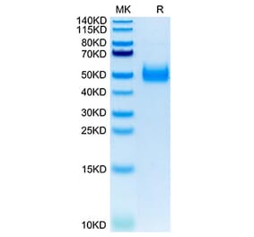 Tris-Bis PAGE - Recombinant Human IL-17RB Protein (C-terminal His Tag) (A330836) - Antibodies.com