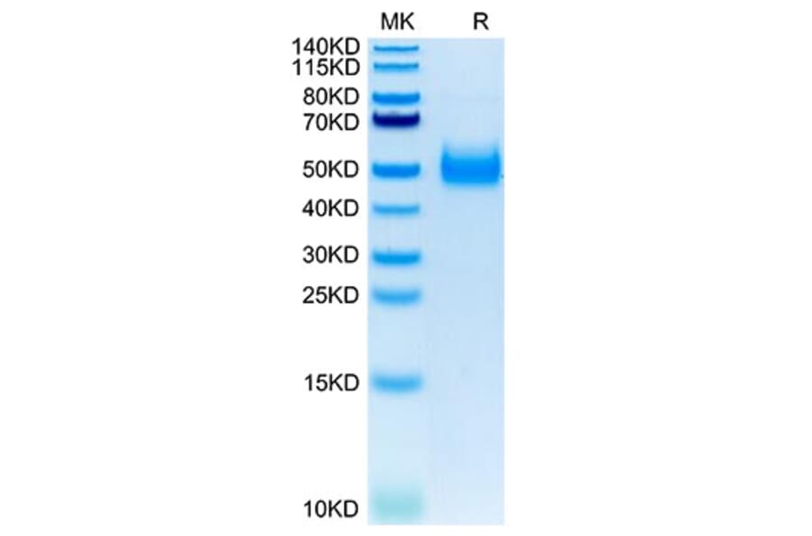Tris-Bis PAGE - Recombinant Human IL-17RB Protein (C-terminal His Tag) (A330836) - Antibodies.com