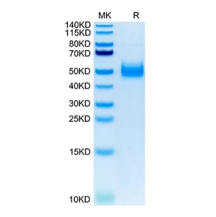 Tris-Bis PAGE - Recombinant Human IL-17RB Protein (C-terminal His Tag) (A330836) - Antibodies.com