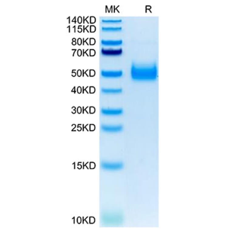 Tris-Bis PAGE - Recombinant Human IL-17RB Protein (C-terminal His Tag) (A330836) - Antibodies.com