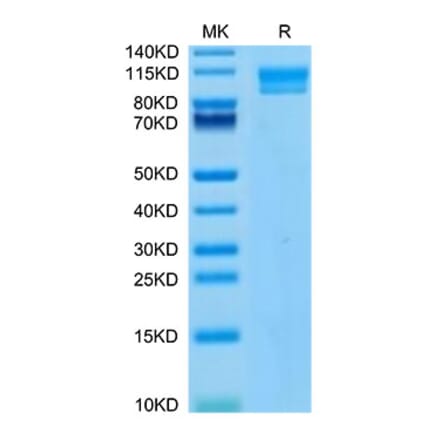 Tris-Bis PAGE - Recombinant Human IL-17RC Protein (C-terminal Human Fc Tag) (A330837) - Antibodies.com