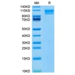 Tris-Bis PAGE - Recombinant Human IL-17RC Protein (C-terminal Human Fc Tag) (A330837) - Antibodies.com