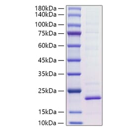 SDS-PAGE - Recombinant Mouse IL-18 Protein (C-terminal His Tag) (A330838) - Antibodies.com