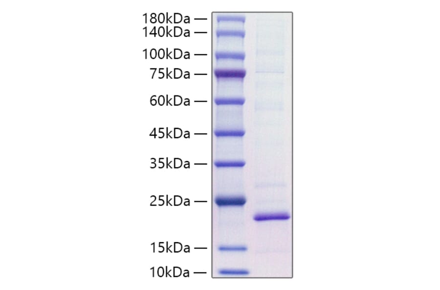 SDS-PAGE - Recombinant Mouse IL-18 Protein (C-terminal His Tag) (A330838) - Antibodies.com