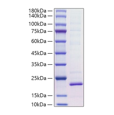SDS-PAGE - Recombinant Mouse IL-18 Protein (C-terminal His Tag) (A330838) - Antibodies.com